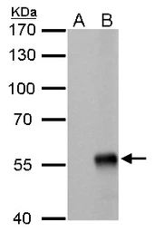 Anti-Influenza A virus Nucleoprotein antibody [GT778] used in Western Blot (WB). GTX629544
